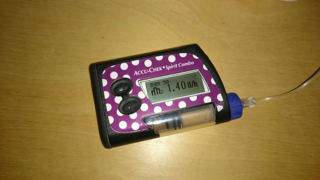 Diabetes Insulinpumpe